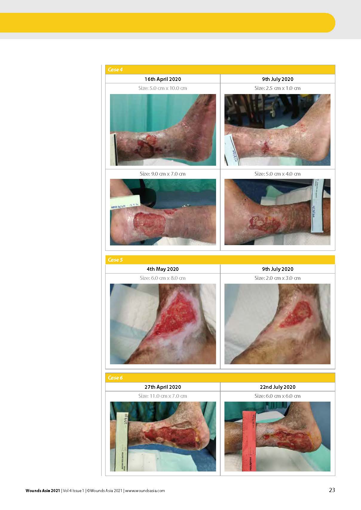 DEFLATE_ A new two layer compression system for managing chronic venous leg ulcers_페이지_5.jpg